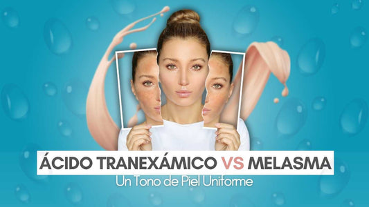 Ácido Tranexámico VS Melasma: Un tono de piel uniforme