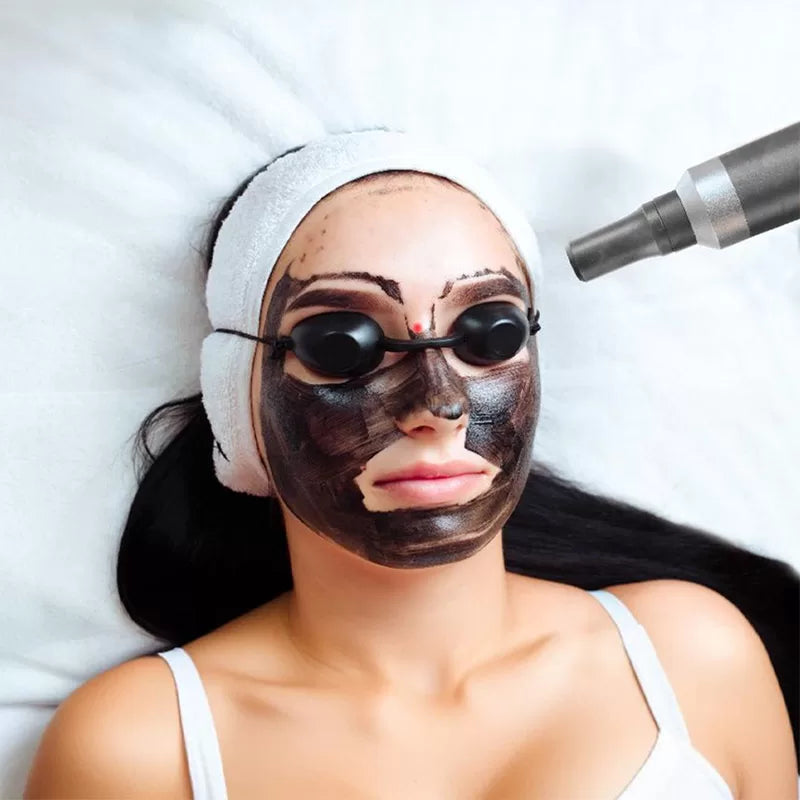 Radiant Glow Carbon Peel"