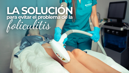 ¿Cuál es la solución para eliminar la foliculitis?