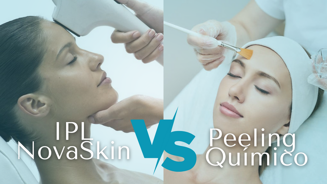 ¿Peeling Químico o NovaSkin IPL? Conoce la diferencia entre ambos tratamientos contra el acné y/o manchas