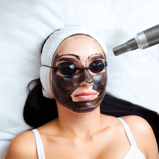 Radiant Glow Carbon Peel"